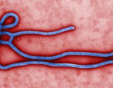 Colorized microscopic image of the Ebola virus. Photo from CDC / Wikimedia Commons.
